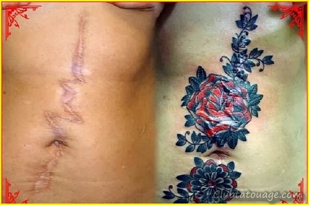 Tatouages sur les cicatrices Photos