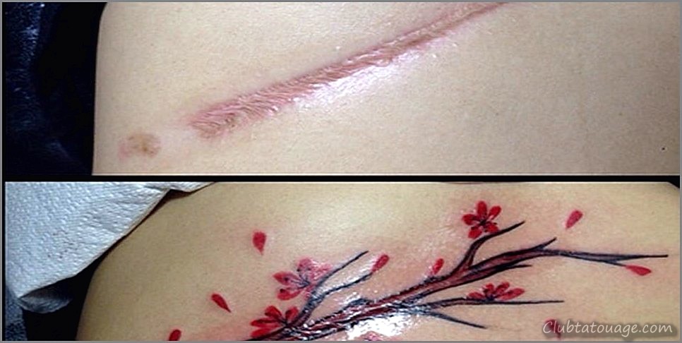 Tatouages sur les cicatrices Photos